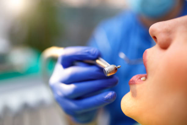 Full Mouth Reconstruction in Milan, NM